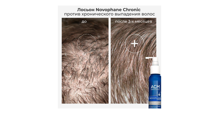 До/После